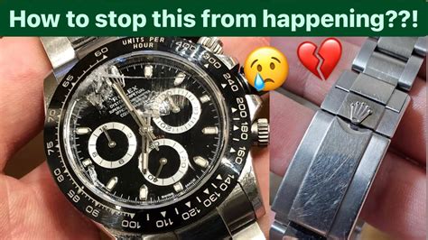 should i worry about scratching my rolex.